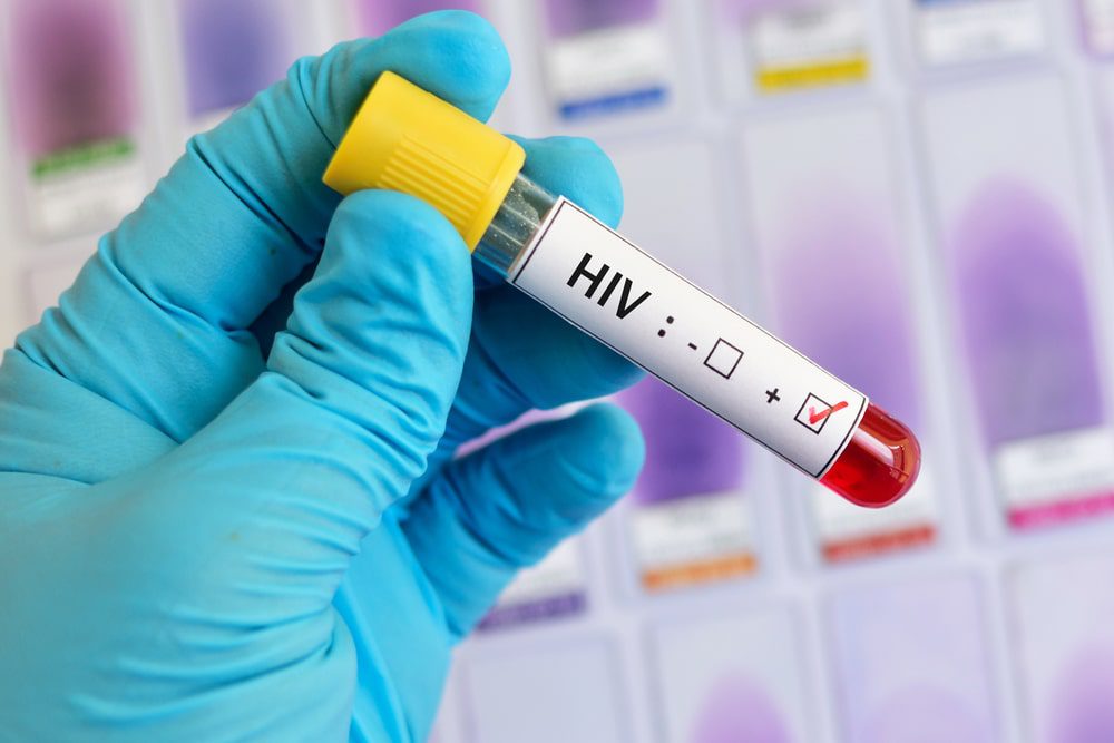 علائم ایدز با اولین رابطه جنسی به Hiv مبتلا می شویم؟ 