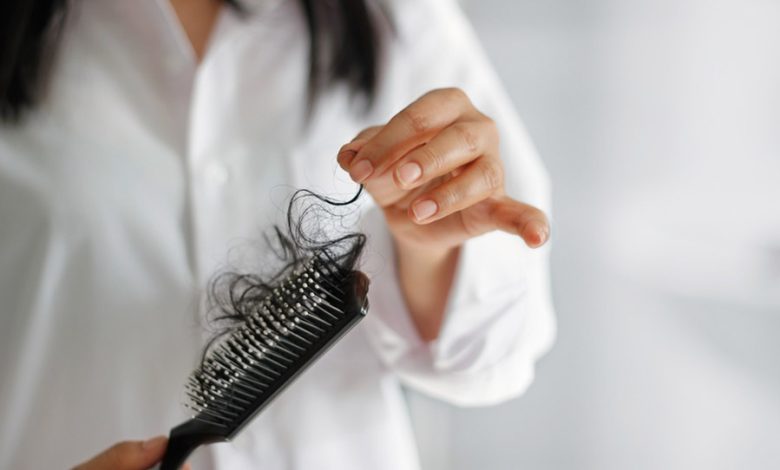 ریزش مو ناگهانی در زنان 