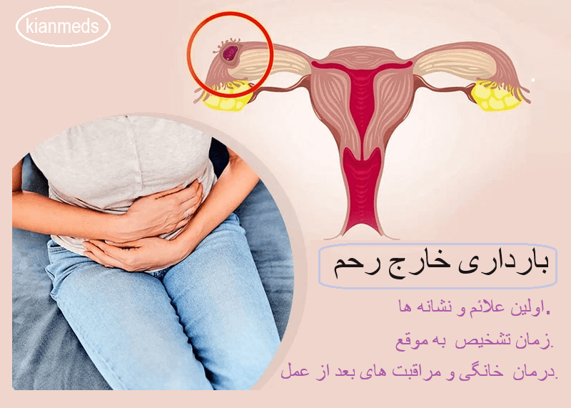 درمان حاملگی خارج از رحم . عوارض بعد از عمل بارداری خارج رحمی